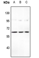 1 - Anti-STEAP2 Antibody AP60819