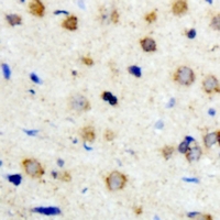 19 - Anti-ICK Antibody AP60820