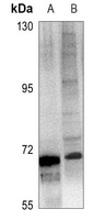 1 - Anti-ICK Antibody AP60820