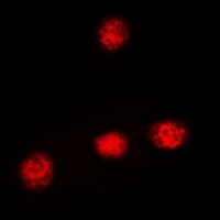 3 - Anti-XRCC3 Antibody AP60821