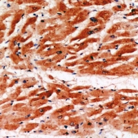 19 - Anti-MYBPC3 Antibody AP60822