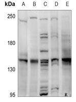 1 - Anti-MYBPC3 Antibody AP60822