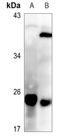 1 - Anti-SFT2D3 Antibody AP60824