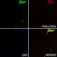 3 - Anti-CACNG5 Antibody AP60825