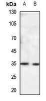 1 - Anti-CACNG5 Antibody AP60825
