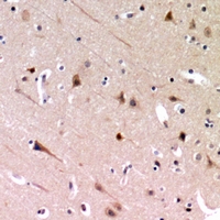 19 - Anti-ZP2 Antibody AP60826
