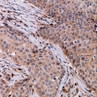 19 - Anti-VPS54 Antibody AP60827