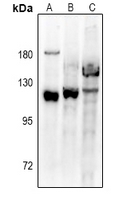 1 - Anti-VPS54 Antibody AP60827