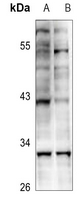1 - Anti-KLF13 (Acetyl-K166) Antibody AP60832
