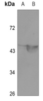 1 - Anti-MEF2A (Acetyl-K403) Antibody AP60833