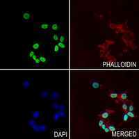 3 - Anti-SMAD2/3 (Acetyl-K19) Antibody AP60834