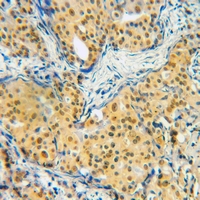 19 - Anti-SMAD2/3 (Acetyl-K19) Antibody AP60834
