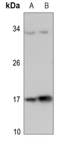 1 - Anti-Histone H3 (TriMethyl-K37) Antibody AP60835