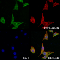 3 - Anti-CD240d Antibody AP60836