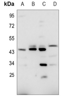 1 - Anti-CD240d Antibody AP60836