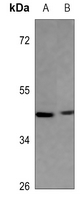 1 - Anti-IDH3 gamma Antibody AP60838