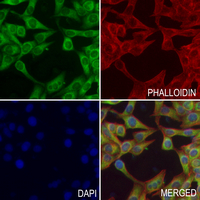 3 - Anti-Apolipoprotein A5 Antibody AP60839