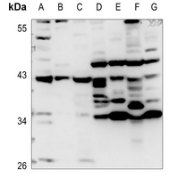 1 - Anti-Apolipoprotein A5 Antibody AP60839