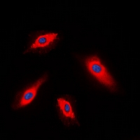 3 - Anti-ALPK1 Antibody AP60840