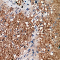 19 - Anti-ALPK1 Antibody AP60840