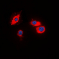 3 - Anti-CIDEB Antibody AP60841