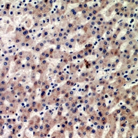 19 - Anti-CIDEB Antibody AP60841