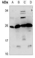1 - Anti-CIDEB Antibody AP60841