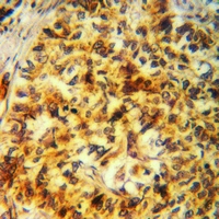 19 - Anti-FUK Antibody AP60842