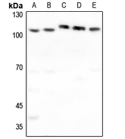 1 - Anti-FUK Antibody AP60842