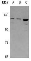 1 - Anti-ABCF1 Antibody AP60844