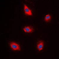3 - Anti-EPS8L1 Antibody AP60845