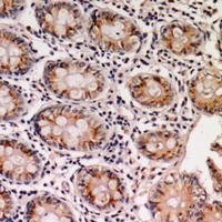 19 - Anti-EPS8L1 Antibody AP60845