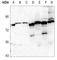 1 - Anti-EPS8L1 Antibody AP60845