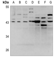 1 - Anti-LPAAT gamma Antibody AP60847