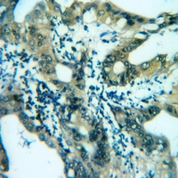 19 - Anti-Carbonic Anhydrase 13 Antibody AP60848