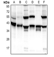 1 - Anti-Carbonic Anhydrase 13 Antibody AP60848