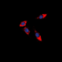 3 - Anti-PDCD12 Antibody AP60849