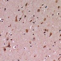 19 - Anti-PDCD12 Antibody AP60849
