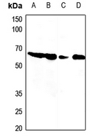 1 - Anti-PDCD12 Antibody AP60849