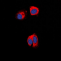 3 - Anti-AAK1 Antibody AP60850