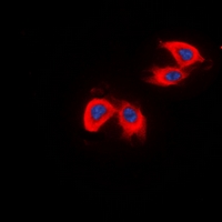 3 - Anti-DCLK2 Antibody AP60851