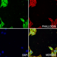 3 - Anti-Alpha-actin Antibody AP60852
