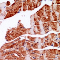 19 - Anti-Alpha-actin Antibody AP60852