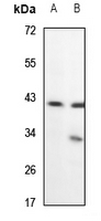 1 - Anti-Alpha-actin Antibody AP60852