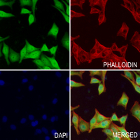 3 - Anti-K Cadherin Antibody AP60853