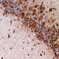 19 - Anti-K Cadherin Antibody AP60853