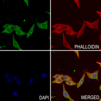 3 - Anti-TRP14 Antibody AP60854