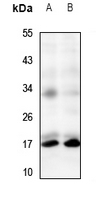 1 - Anti-TRP14 Antibody AP60854