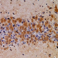 19 - Anti-Latexin Antibody AP60855