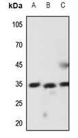 1 - Anti-Latexin Antibody AP60855
